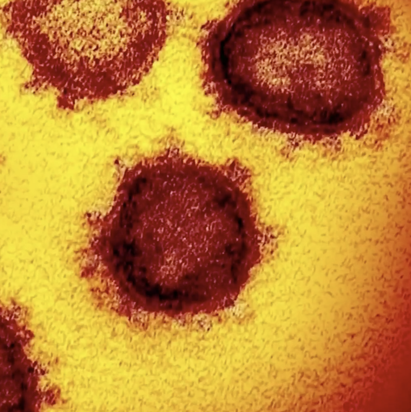 FL_Residents & staff at Macclenny nursing home tested for virus Image